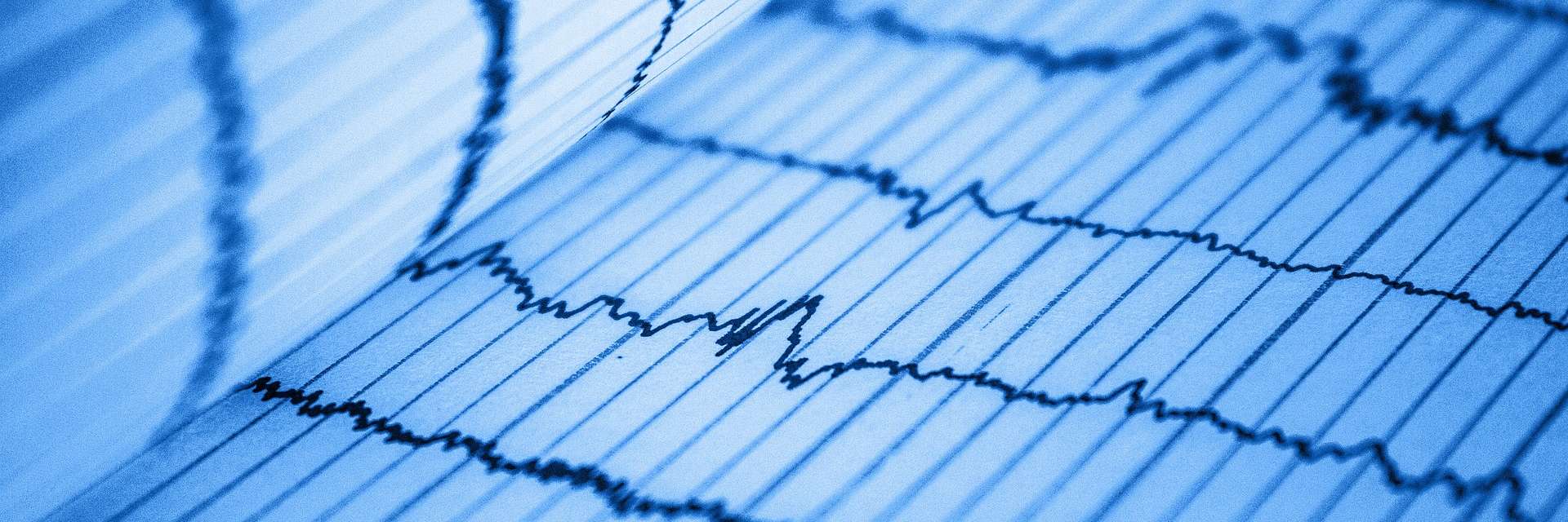 Symbolbild: EKG-Kurven - https://pixabay.com/users/rezendeluan-9690153/